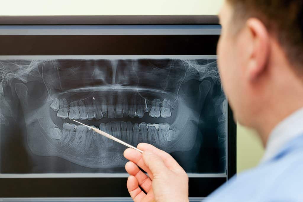 A dentist examining a dental xray