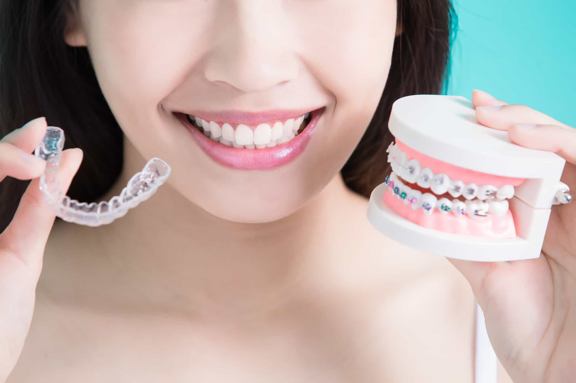 we discuss the differences and similarities of invisalign vs braces
